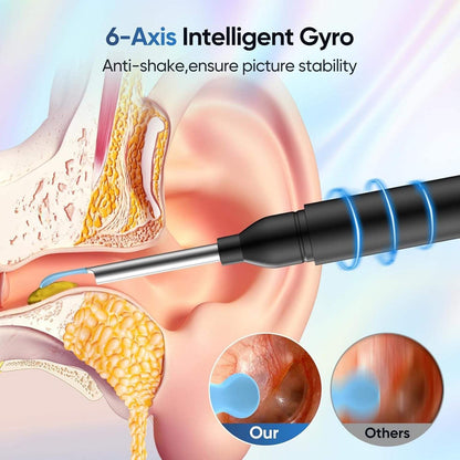 Earwax Removal Tool with Camera, 8 Kits and 5 Ear Picks, (camera 1080P HD), 6 LED Lights Earwax Removal Kit, for IOS and Android